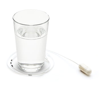 Ce rezultate de lungă durată exista? inel-balon-gastric-allurion